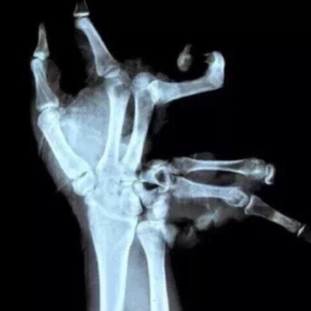 When your throwing partner goes 100% from 45 ft.