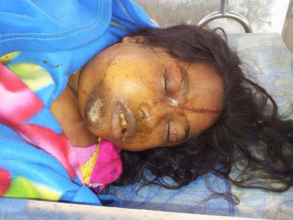 AL_Staff's tweet photo. Another Pregnant #Rohingya Woman Killed in Sittwe Hopsital http://t.co/6GMzPrJiBH @USEmbassyBurma #ObamaInMyanmar http://t.co/RxzXwl0reg