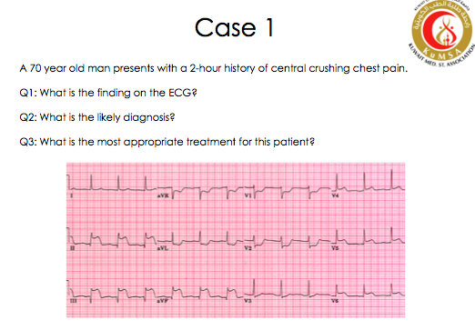 KuMSA_QnA's tweet photo. #medicine #cardio #clincalcase #eloops http://t.co/yVmUNSBeFy
