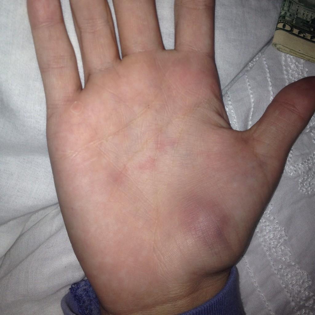 natalieswershay's tweet image. this is the most painful sport I have ever been in #colorguardproblems