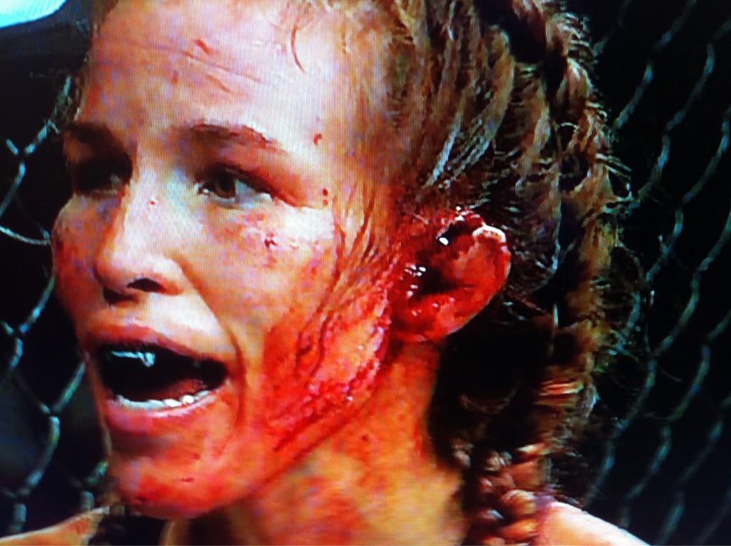 Watching UFC n Leslie Smith cauliflower ear literally explodes everywhere a...