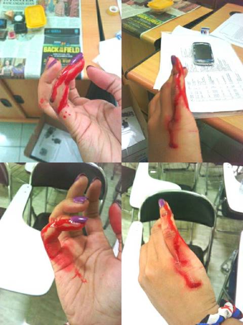 MChyemi_'s tweet photo. Bleeding finger http://t.co/kZkRKKLD35
