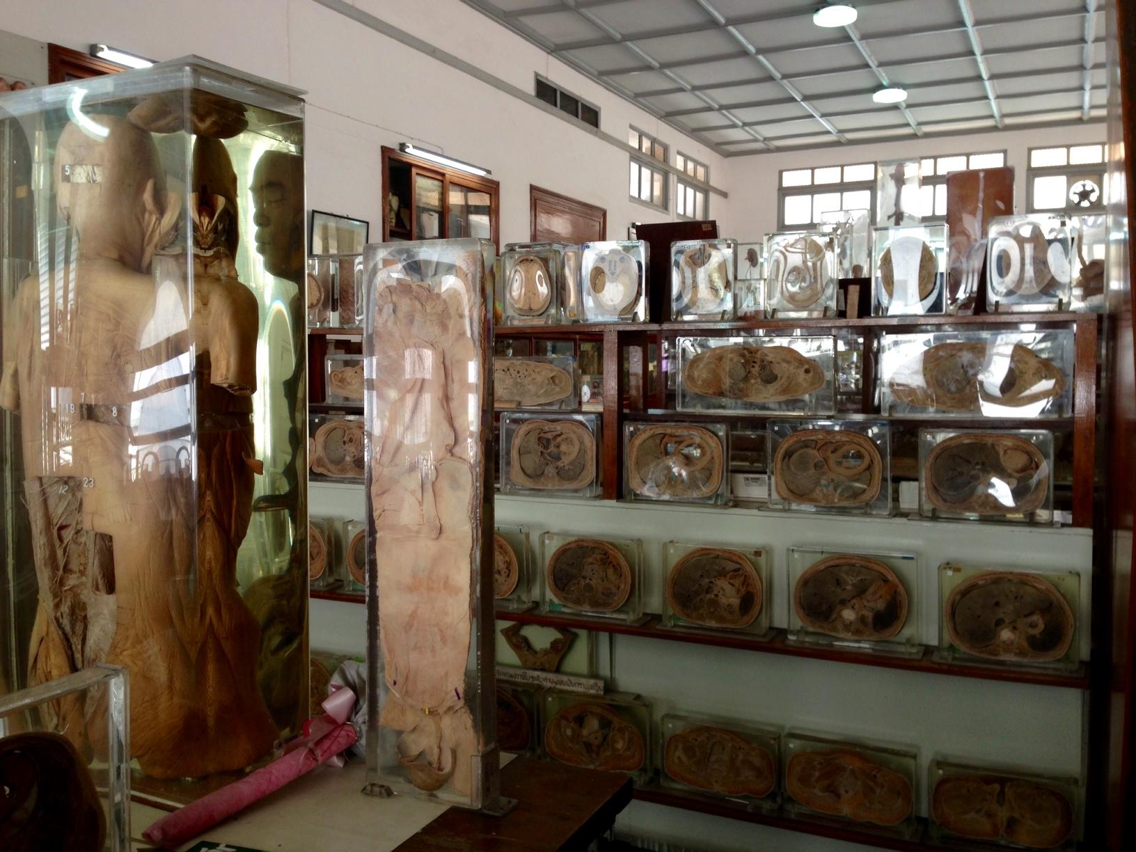 終末オトナ遠足 on X: 遠足ログ:（グロ注意）タイ・シリラート病院内にある死体博物館。人体の輪切りや奇形児の遺体、病気に冒された内蔵、轢死体の写真など展示されている。正直グロイがすぐ慣れた。現地の中学生が来ていてはしゃぎながら見ていた  http:t.co ...