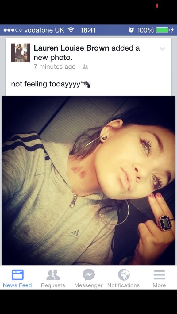 norwichcunts's tweet photo. "Don't look at my hickey" http://t.co/nfGFKfbJsB