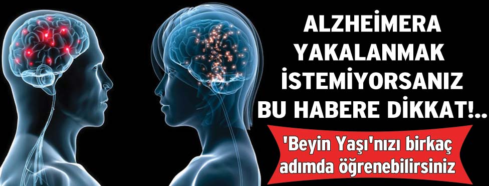 gazetesozcu's tweet photo. Beyin yaşınızı hesaplayın
--->>>>>>http://t.co/C1B25GU46C http://t.co/KqSxGWb1fH