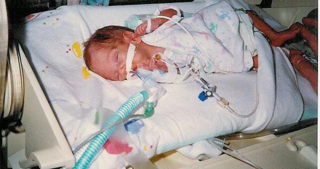 .@MarchofDimes saved my life 25 yrs ago with #SurfactantTherapy research study. 1lb 10.5oz 27wks #WorldPrematurityDay