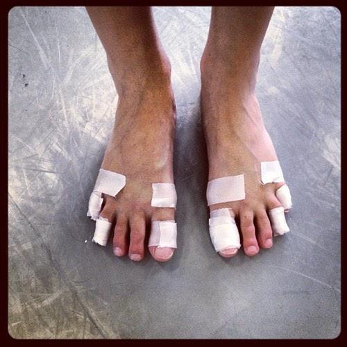 Стерла стопу. Стерла стопу. Стерла стопу. Стерла стопу. Стерла стопу.