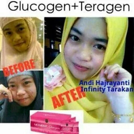 zharvan's tweet photo. CANTIK, PUTIH, BEBAS JERAWAT,, yuk atasi dengan #glucogen.. Spesial price loh + free #teragen.. 😉| pin BBM: 7DA7E051 http://t.co/MaDcKrPZId