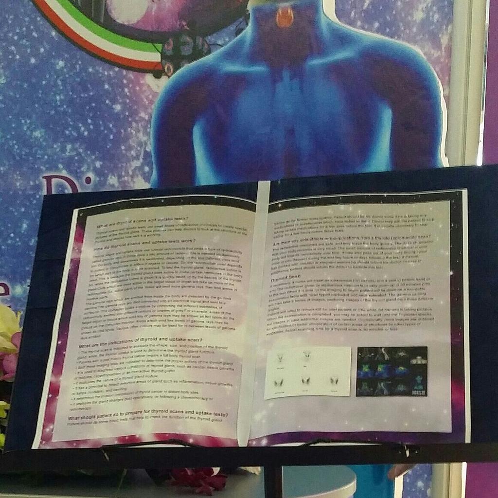 مجسم ومعلومة - من الاشياء اللي تميز فيها بوث السنه لفعاليات اسبوع الطب النووي في دوله الكويت 16-20 نوفمبر 2014