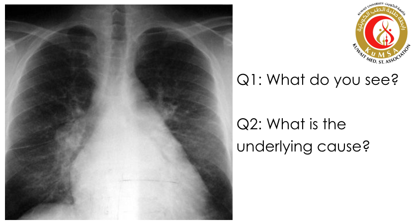 KuMSA_QnA's tweet photo. #medicine #clinical #cardio #eloops http://t.co/R7RUrTNZEV