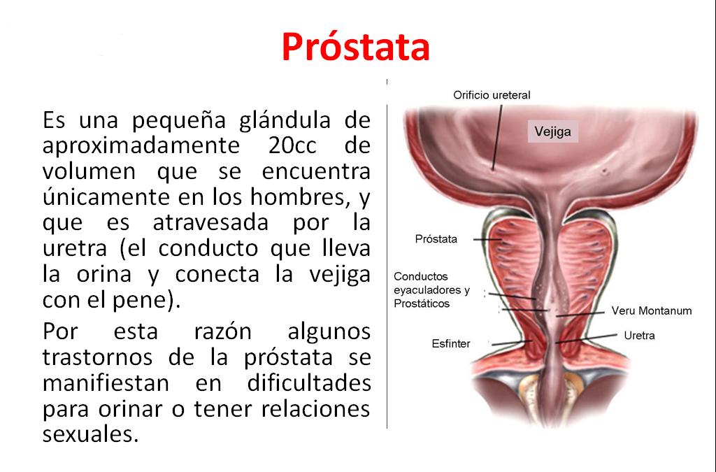 tener una próstata pequeña tener una próstata pequeña