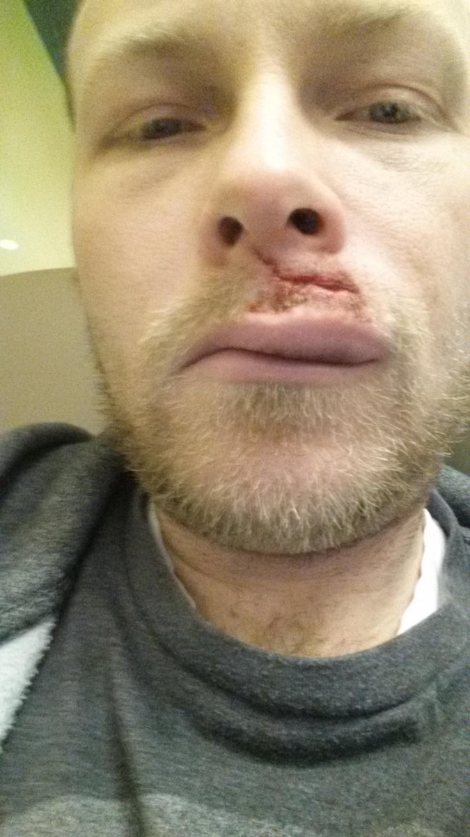 chefdave22's tweet photo. Holy STICK.  ME"Get that guys name."
I think it was Easton. http://t.co/icEUrbHxED