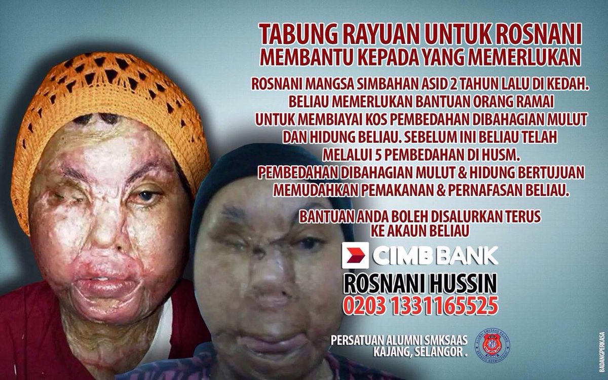 aryaniahmad8's tweet photo. Mohon jasa baik utk RT.Mungkin dgn jasa baik anda,dgn izin Allah dpt bantu mangsa teruskan kehidupan yg lebih baik. http://t.co/0aWDidpCEx