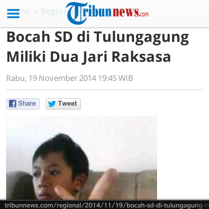 INDONESIAinLOVE's tweet photo. Miliki 2 Jari Raksasa Bocah SD di Tulungagung Indonesia : http://t.co/YBc5URgLlS