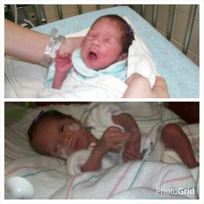 Nunca me dieron esperanzas de vida para una de ellas su peso al nacer fueron 2 y 3 lb #quiero5delarry&nbsp;#larryhernandez<a href="/tag/quiero5delarry"class="tags"><span>#quiero5delarry</span></a><a href="/tag/larryhernandez"class="tags"><span>#larryhernandez</span></a>