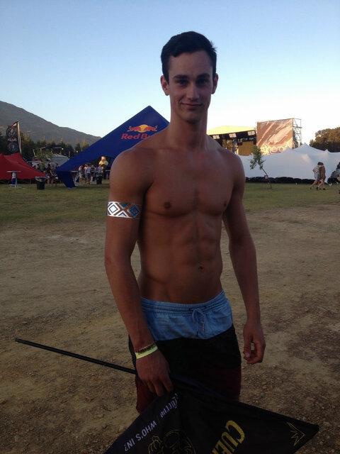 Two days later and still feeling burnt haha