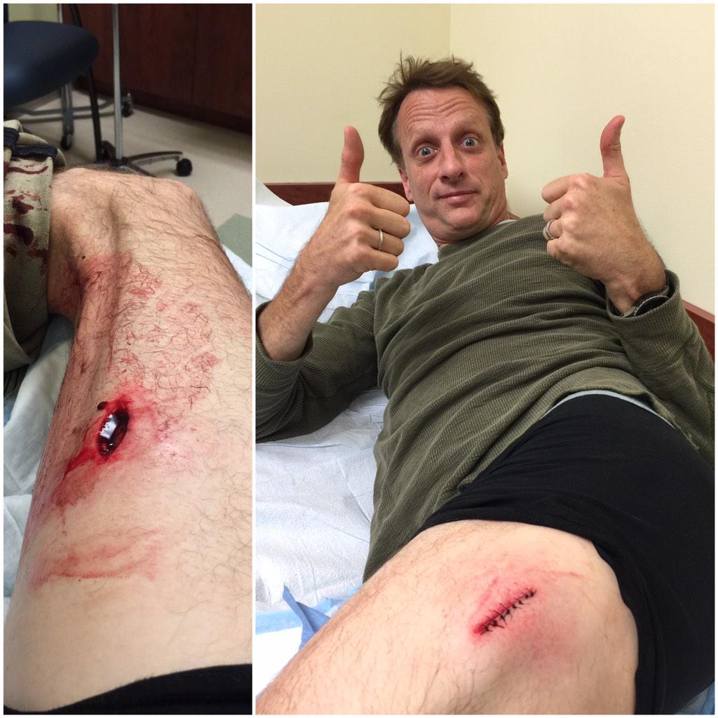 tonyhawk's tweet photo. Living the dream! (but today kinda sucked) http://t.co/WAvADvsBfk