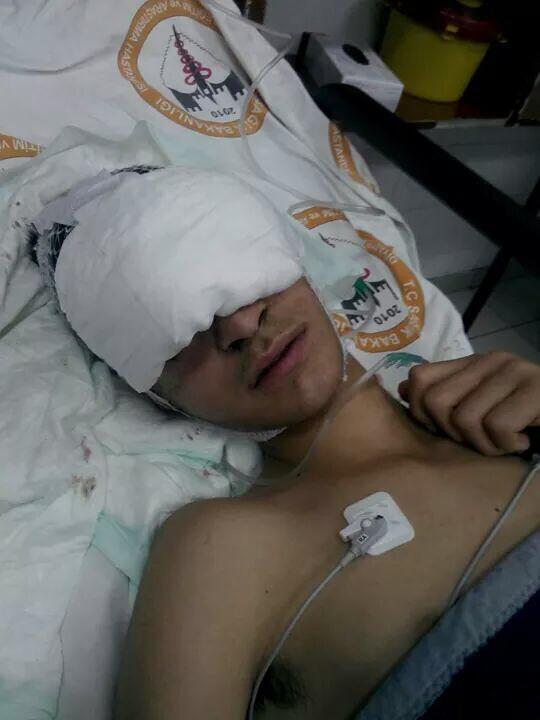 VKesanbiIici's tweet photo. #MustafaSolmaz 
@okarcioglu1: Mustafa 15 yaşında, polis tarafından vurulup kör oldu. http://t.co/TgdDgto6v0
