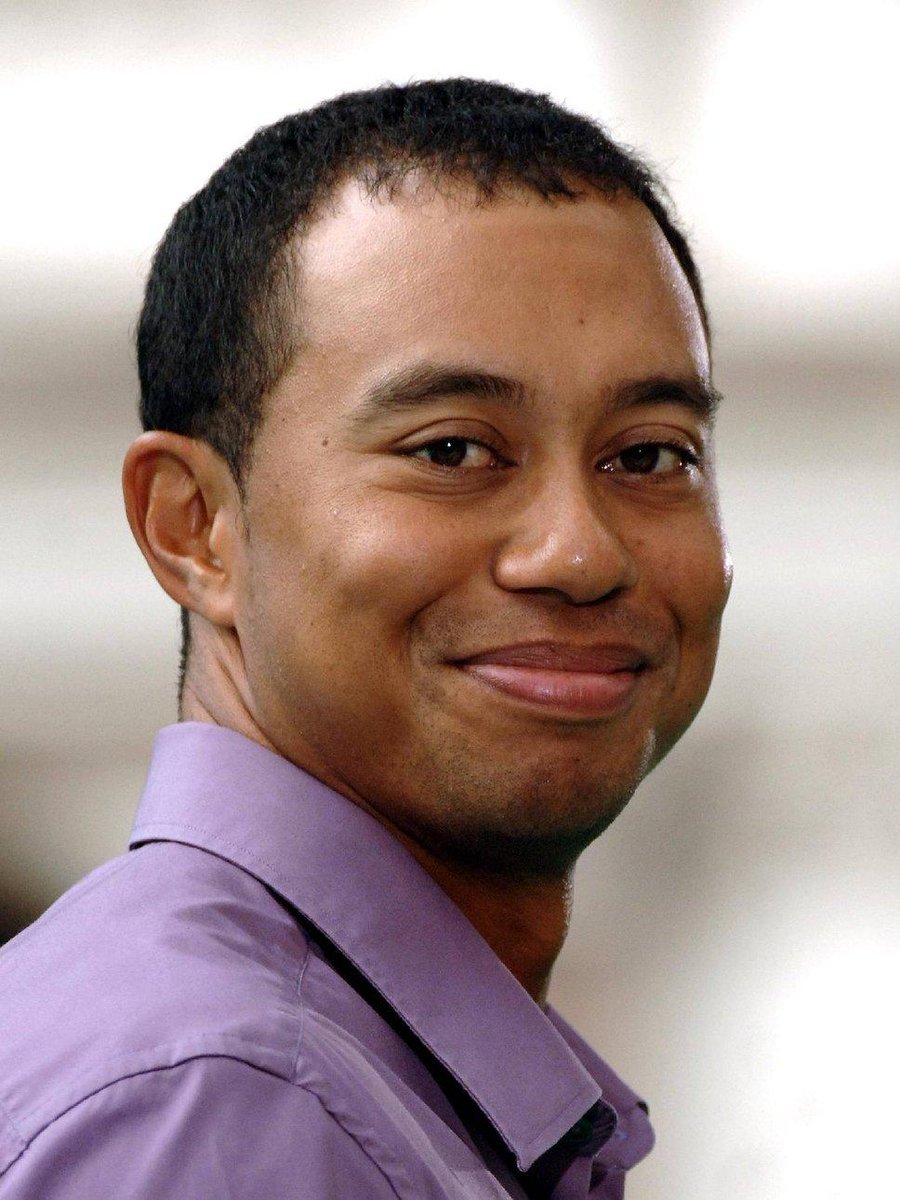 Leimo's tweet photo. Recently Tiger Woods admitted to Fox sports that there is one contest he's had to concede to – that of hair loss... http://t.co/b00gFyf6yz