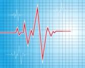 NotSinus's tweet photo. Time for a pacemaker? http://t.co/nLUcinyb8p