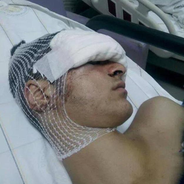 madammfakiir's tweet photo. Hatırlatma:15 yaşında,polis tarafından vurulup kör oldu..Adaletiniz batsın!
#MustafaSolmaz http://t.co/PcqyFAJbrZ