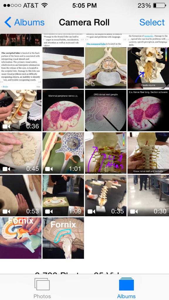 What your camera roll looks like when taking anatomy. #deadcat #motorneuron #schwanncell