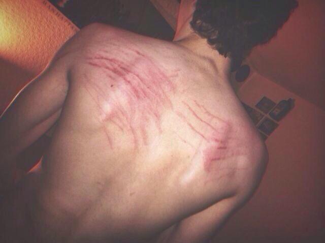When he scratches you so hard that you bleed😍