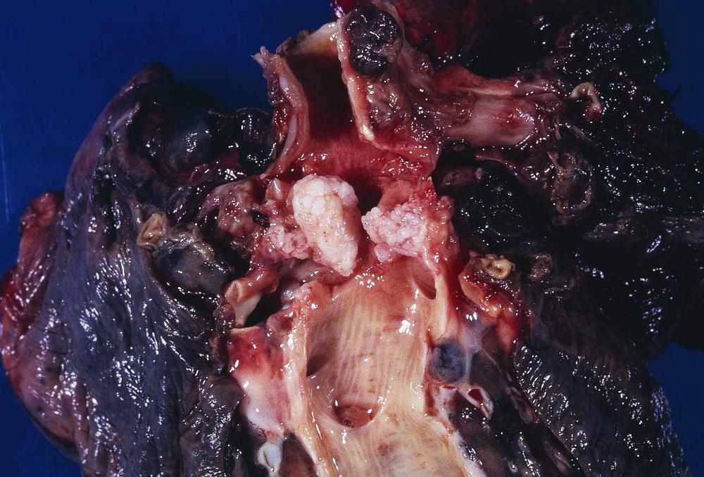 whizbaproperty's tweet photo. This may well be the cure for cancer!
http://t.co/48b6Bw6b1K #Cancer #cancersurvivor #PoCchat #mmchat #health http://t.co/Jr96VcxGxs