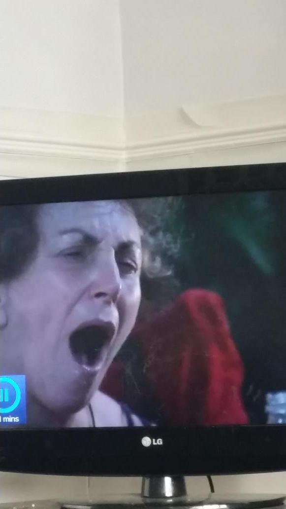 Danielle161212's tweet photo. Catching up on @imacelebrity. Show is ya cum face #EdwinaCurrie #scarredforlife http://t.co/hSHEElSh2u