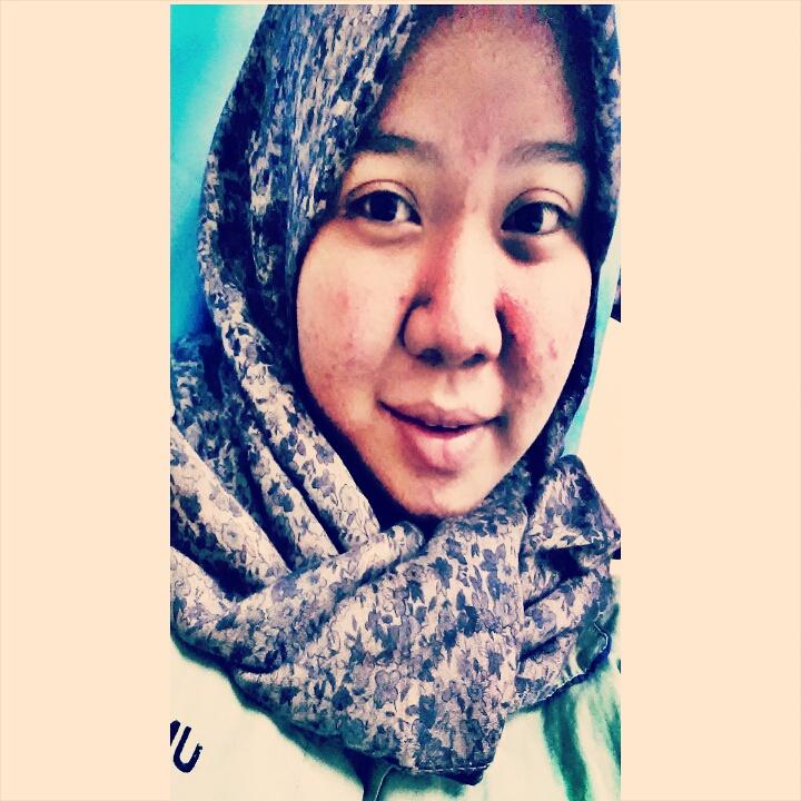 CxcxSyfq's tweet photo. Pagi dunia ♥ http://t.co/x6rNWLwcBE