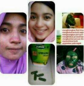 Masker_Hebat's tweet photo. Wajah kusam? Bopeng? Banyak jerawat? Masker Spirulina solusinya!! Wajah akan kembali cerah &amp; mulus.. Pin: 53A74B13 ;) http://t.co/r3ZIcWH1CI