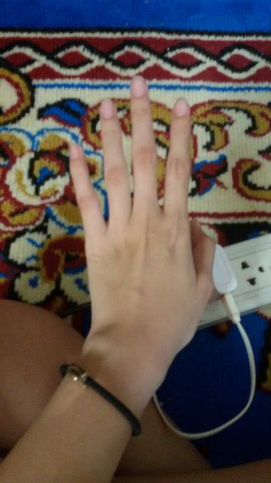 ether_CAL's tweet photo. @ethermao กูหายดำแล้วเย้ http://t.co/CJrmfjWYTu
