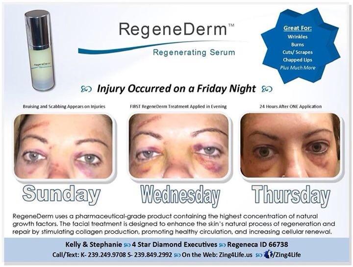 SlimStephanie's tweet photo. I Love This! I use it on everything!!   Helps #collagen too! #natural #growthfactor #RegeneDerm http://t.co/agmNIcyCS2