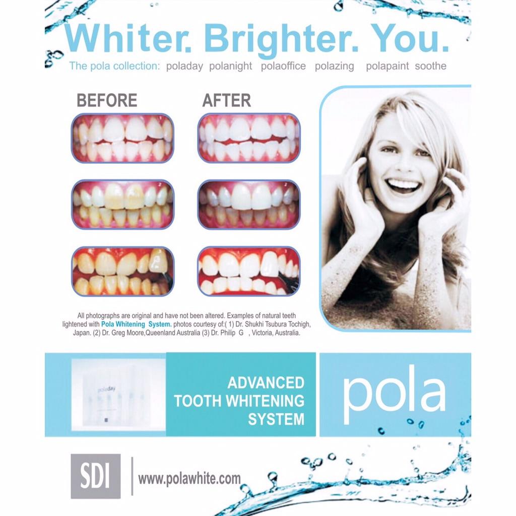 StopTheClockDC's tweet image. Pola Whitening available at STC for £250! Offer throughout December &amp;amp; January! #dentist #smile #pola #whitening 😁❄️💎✨