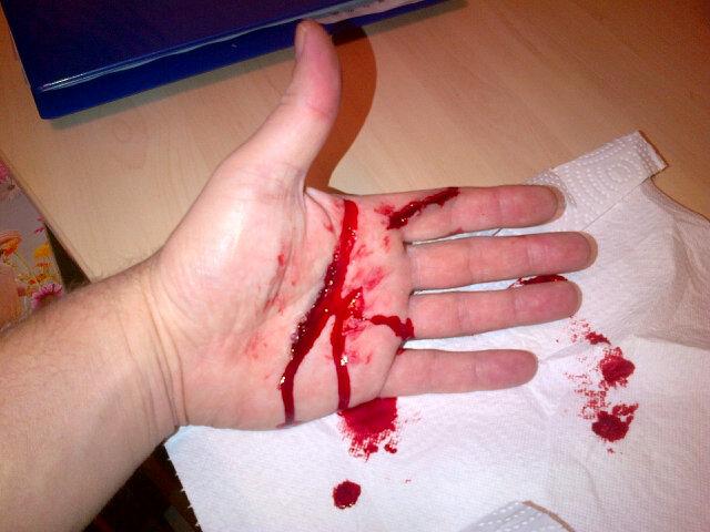 Koning40's tweet image. Ziet er toch weer bedriegelijk echt uit! #lotusslachtoffer #EHBOOP #debinding. Benieuwd hoe de EHBO-reakties zijn!