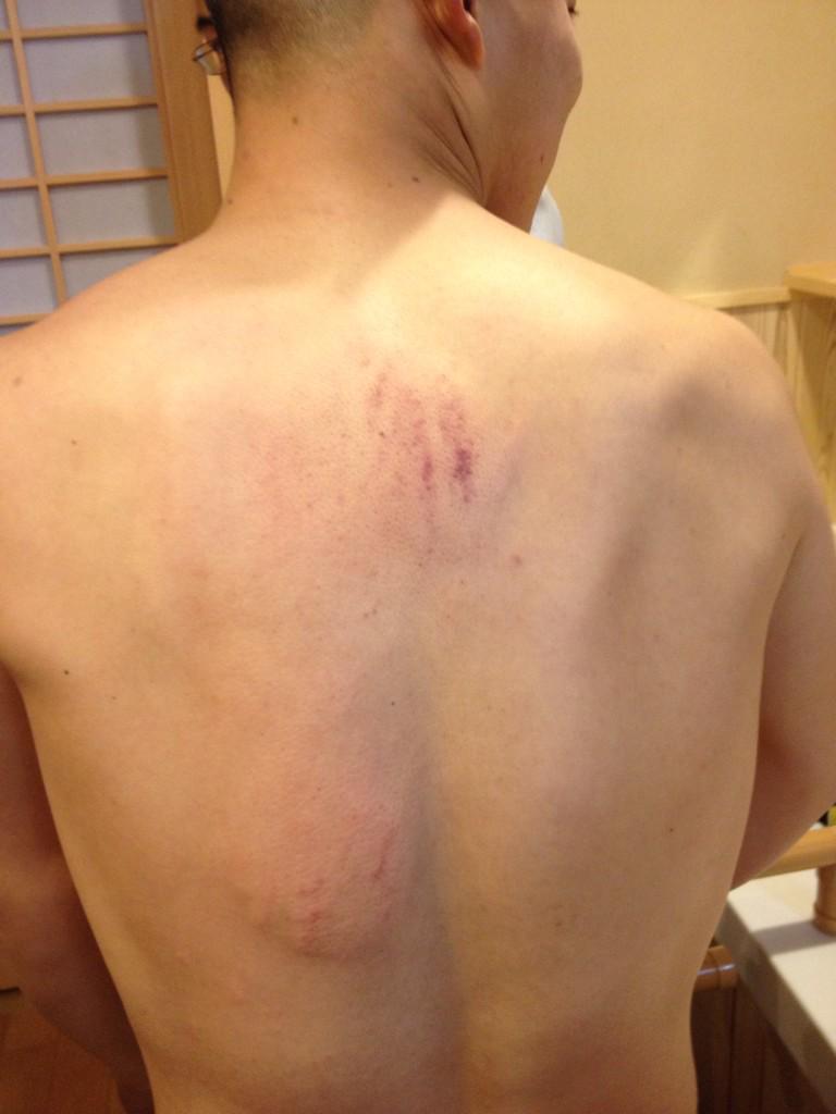 jinama7's tweet photo. 久しぶりの罰警。痛いなー寒い時期やから余計に笑 http://t.co/nQkg6euTAF
