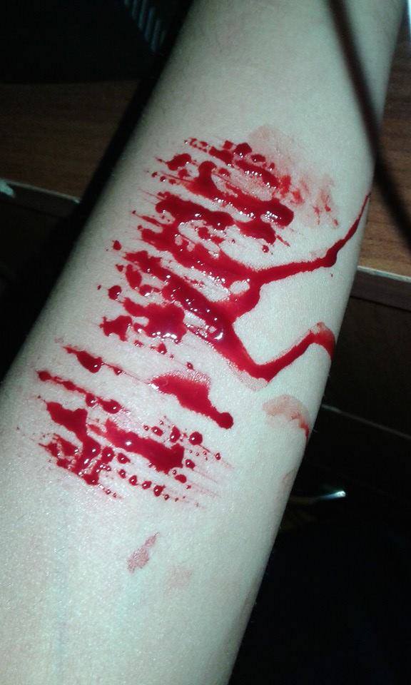 Pelin Abali On Twitter I Cut My Hand Http T Co Hou6cq4wab Twitter