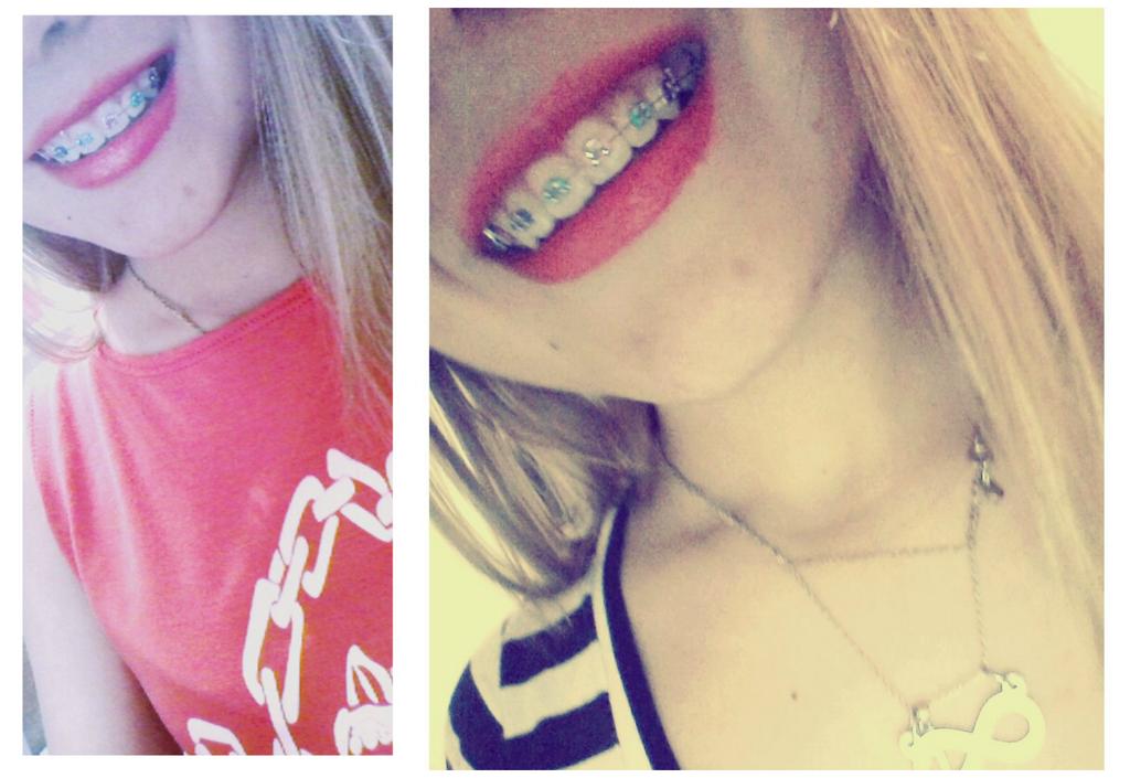camiaquiino's tweet photo. Sonrisa de lataππ #backets #colores #arcoiris #sonrisa http://t.co/WVYZNOF8Mn