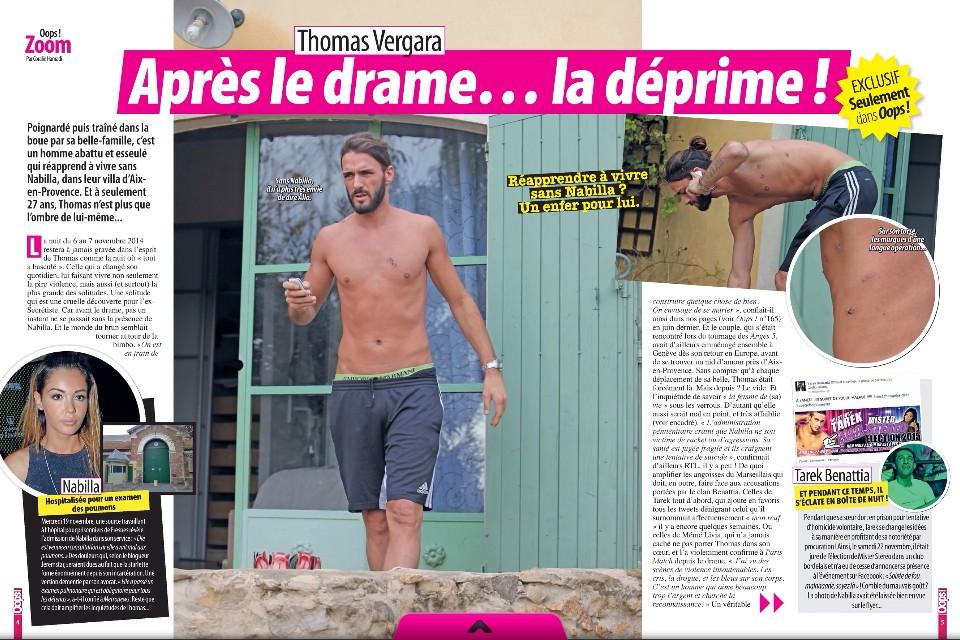 37elodie's tweet photo. Les premières photos de thomas blessé ! @thomasvofficiel @NabillaNews #nabilla #thomas http://t.co/nYwAk7pP1X