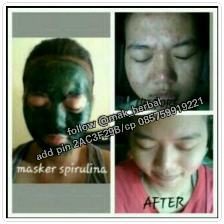 kak @hadayDay Mau Wajahmu bebas dari Jerawat,komedo&Flek Hitam??Cek @mak_herbal  pin 2AC3F29B /CP 085759919221