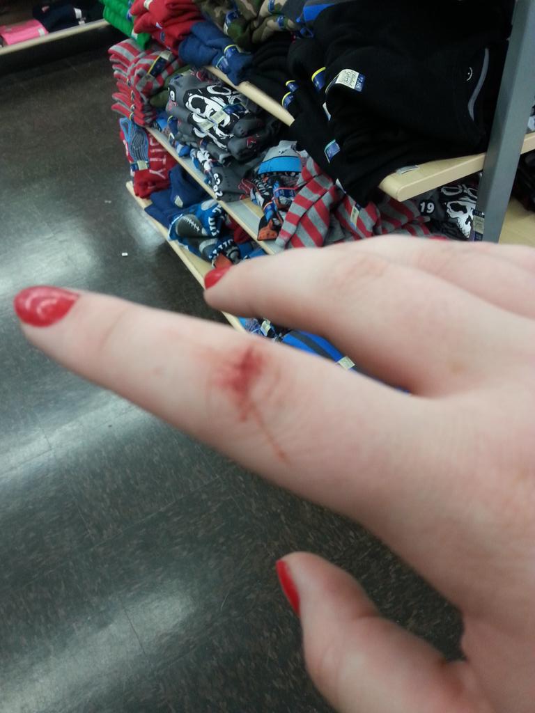 TwerkDatHoe's tweet photo. The warrior wound from grabbin stuff last night lol. #BlackFriday http://t.co/2dccCrIoo6