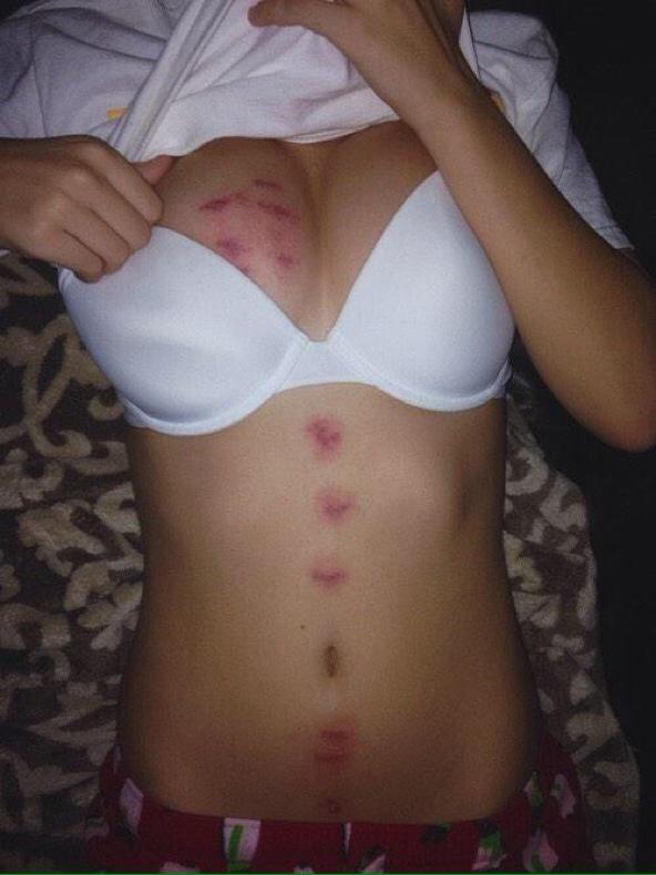 “<a href="/DailyPornSupply/">Daily Porn Supply</a>: hickies where only YOU can see😏😩😍 ”