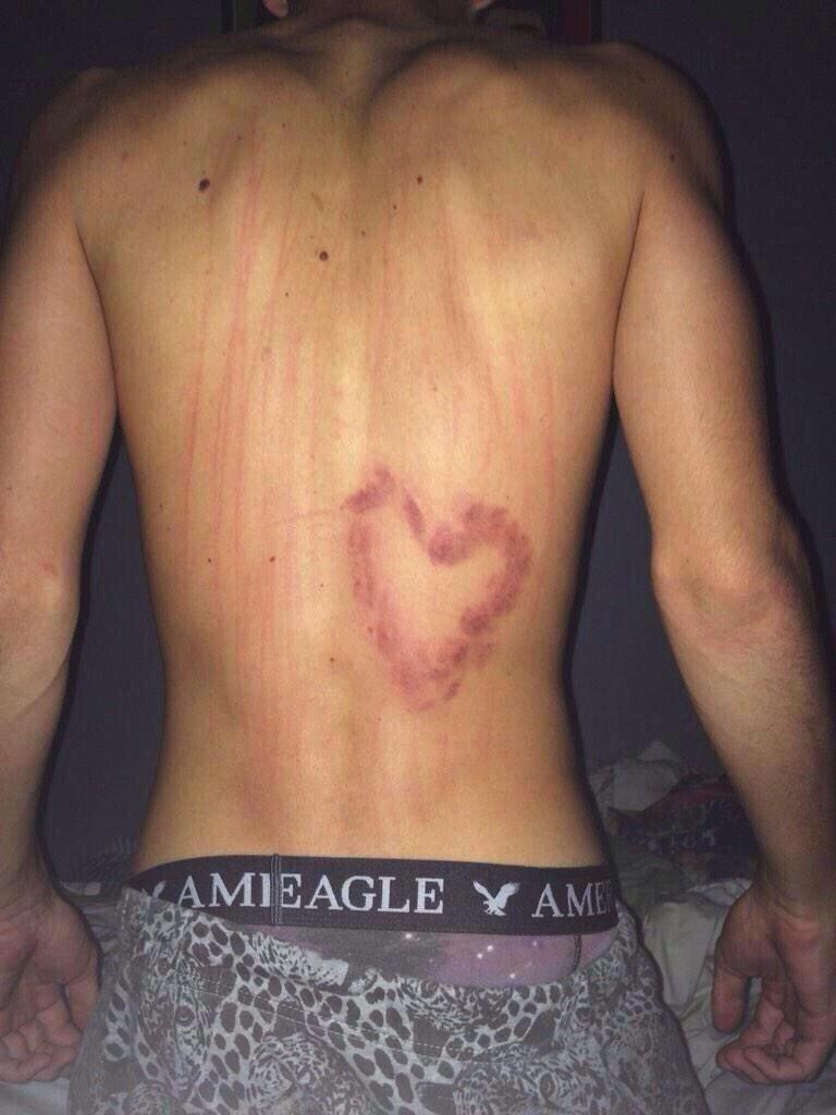 sammyimagines's tweet photo. imagine this being Sammy's back the next morning because of you 😬😏 http://t.co/WTdozQQj3y