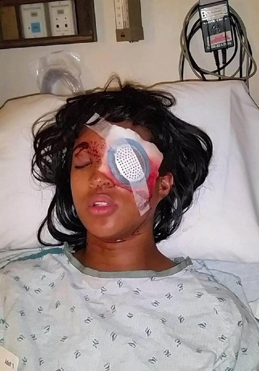 NYDailyNews's tweet image. Pregnant woman loses eye after police fire non-lethal round at car during #Ferguson protest. nydn.us/1pws122