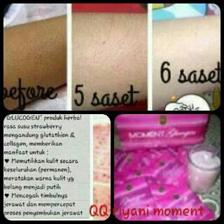 cummule's tweet photo. Muka Putih Kaki Belang?? ih..hri giniX_X.. Bkin Kinclong slruh tubuh km donk, Minum GLUCOGEN Tratur, bye bye Belang.. http://t.co/dsgFy77gXl