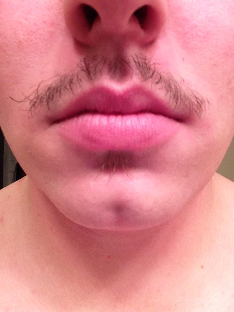 kernstain7's tweet photo. I'm so happy to get rid of this gross thing #Movember2014 #poorshow #betterlucknext http://t.co/KEfoqOFKiA