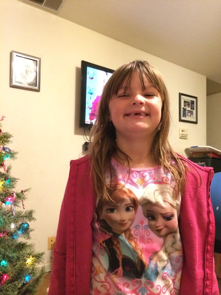 rccsurvivor08's tweet image. #2frontteeth all I want for Christmas