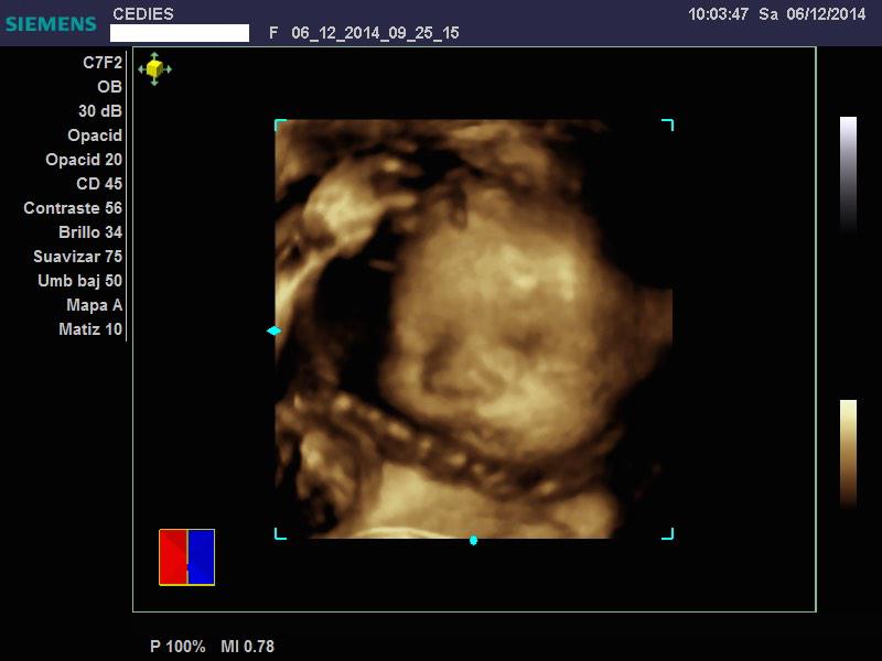 CediesSpm's tweet photo. Sonografia 3D/4D http://t.co/yee3D3sldg