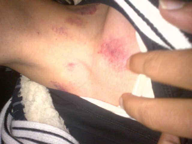 diodedoode's tweet photo. http://t.co/OvqRwnW1rR