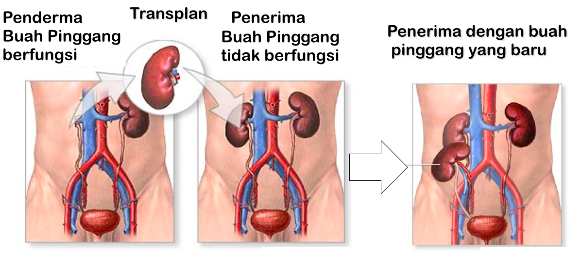 PEMINDAHAN BUAH PINGGANG? BERAPA DOS PENGAMBILAN MZ YANG DIPERLUKAN. JOM BACA. I Aafiyat Lifestyle